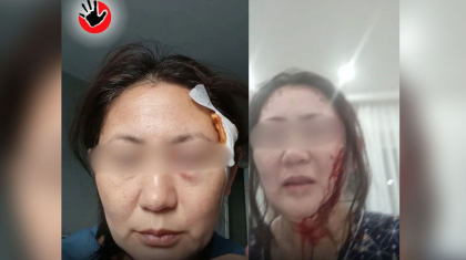 Полиция Ақмола облысында көршісінен оңбай таяқ жеген әйелге қатысты пікір берді