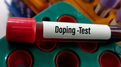 Париж Олимпиадасының чемпионы болған өзбек боксшыдан допинг табылды