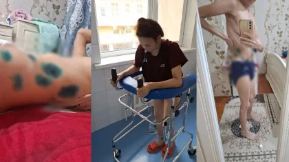 «Өліп қала жаздадым»: Талдықорғанда жаңа босанған келіншек жатырынан айырылды
