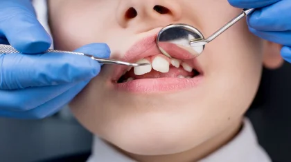 «Барлық тісті бірден емдеуден сақ болыңыз: министр ата-аналарға ескерту жасады