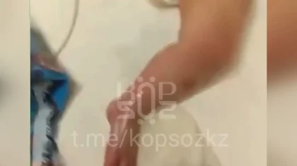 Астана ауруханасындағы дау: сәби емдеу кезінде күйіп қалған (ВИДЕО)