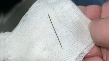 Түркістанда 8 айлық сәбидің ішінен ине шықты