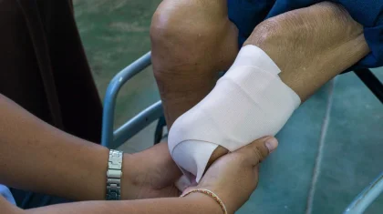 БҚО-да үйсіз-күйсіз жүрген бірнеше адамды үсік шалып, қолы мен аяғынан айырылды