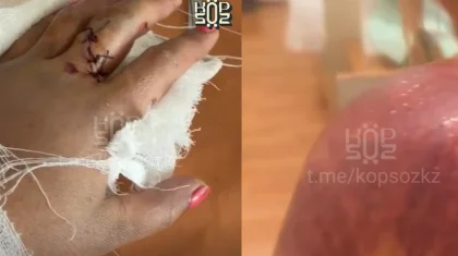 «Сау тамтығы қалмаған»: Жетісу облысында ер адам кішкентай балалалары бар әйелді күрекпен ұрған