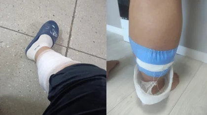 «Енді құтыруға қарсы вакцина алу керек»: Көкшетауда айы-күні жақындаған әйелді бұралқы иттер қауып алған