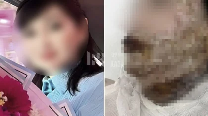 Шымкентте ер адам экс-жұбайының бетіне қышқыл шашқан: әйел ауыр жарақат алды