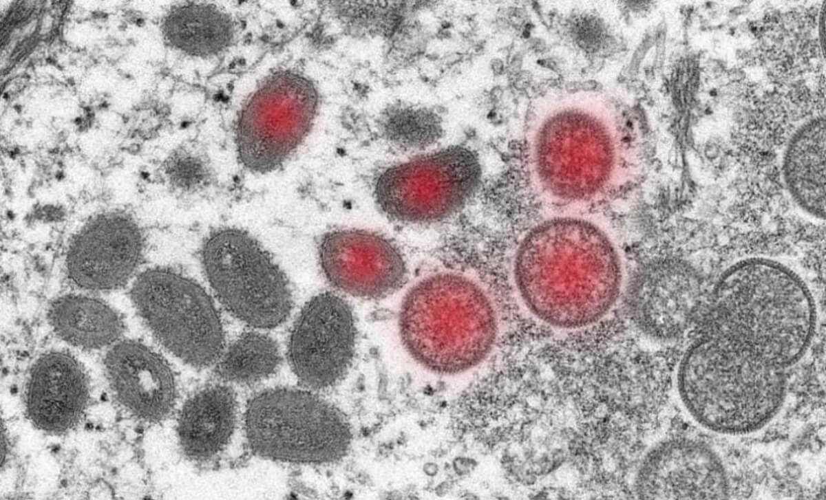 Маймыл шешегі әлемнің 94 елінде тіркелді