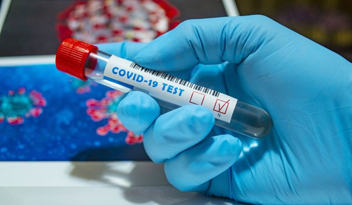 Өткен тәулікте елімізде 74 адам коронавирус жұқтырды